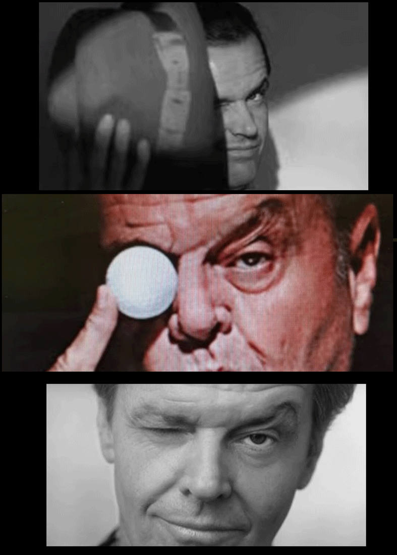 il pomello sotto l occhio